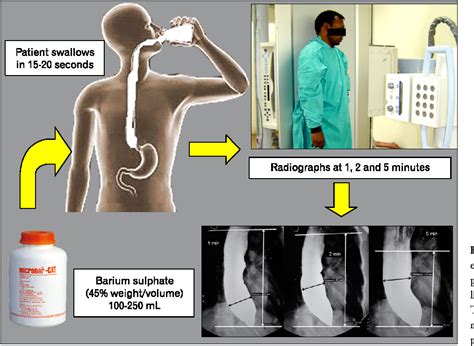 esophagram procedure